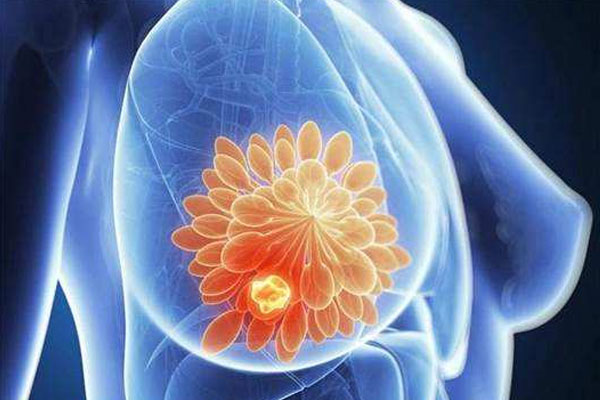 浆细胞乳腺炎病因