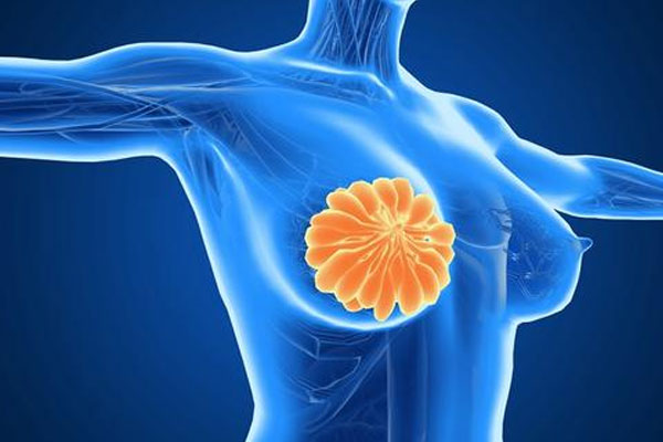 多久应该做一次乳腺相关