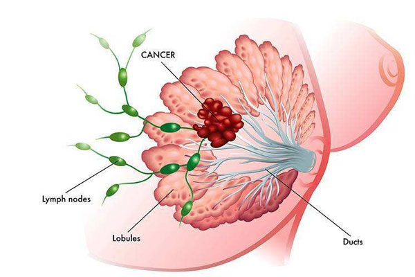 肉芽肿究竟该不该手术?—