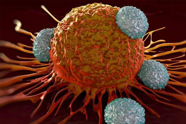 乳腺囊性增生一定会癌变