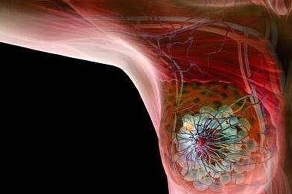 未婚少女为什么会得乳腺